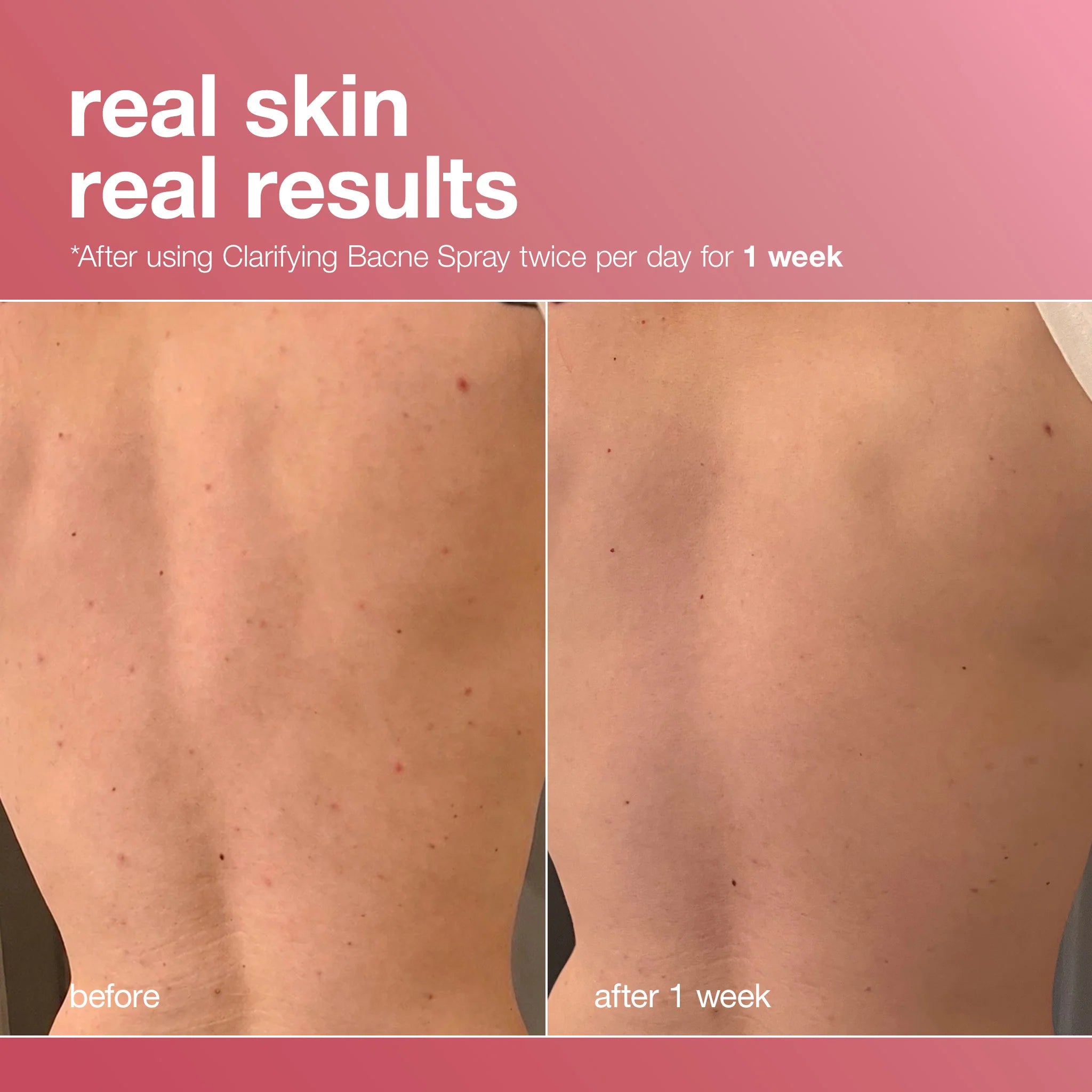 clarifying body spray