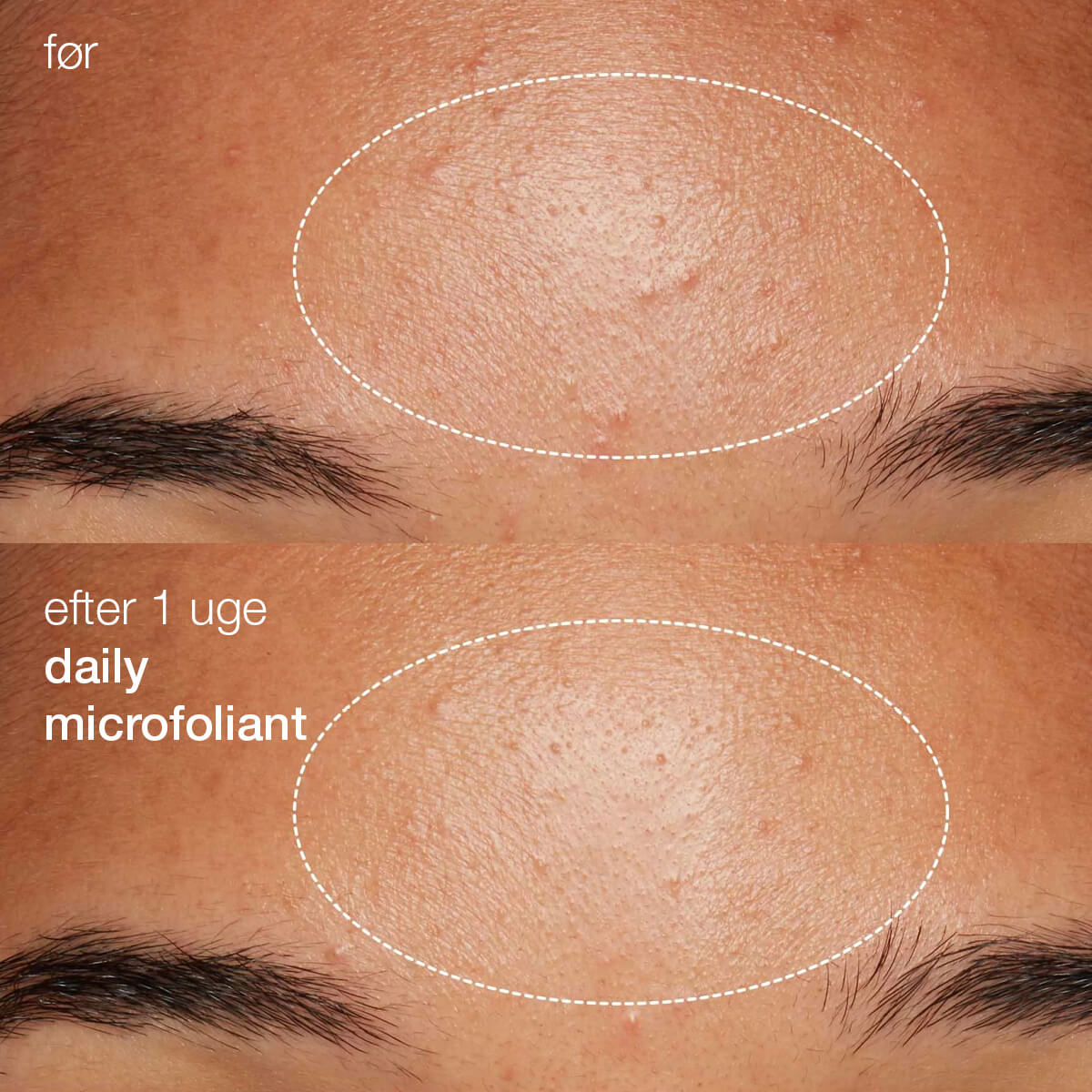 daily microfoliant rensende eksfoliering