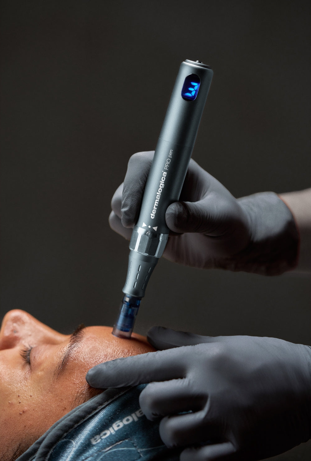 Microneedling og exosomer: Den ultimative kombination for sund og strålende hud