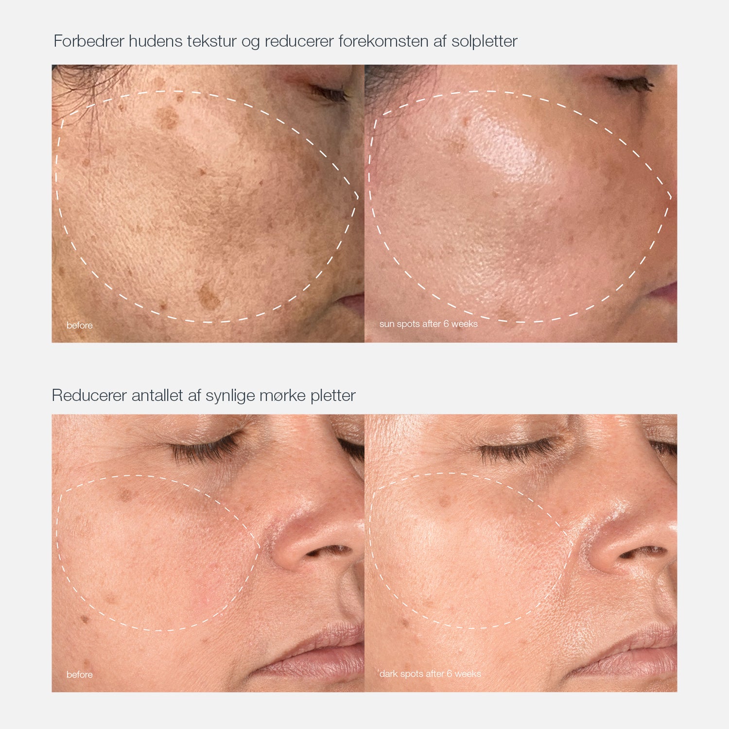 melano PRO ansigtsbehandling