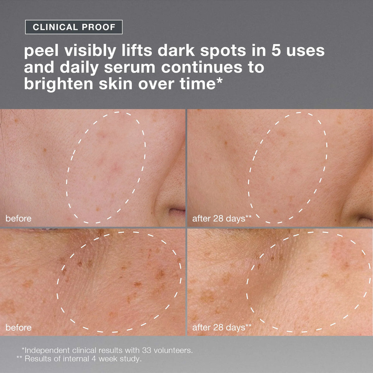 powerbright dark spot system