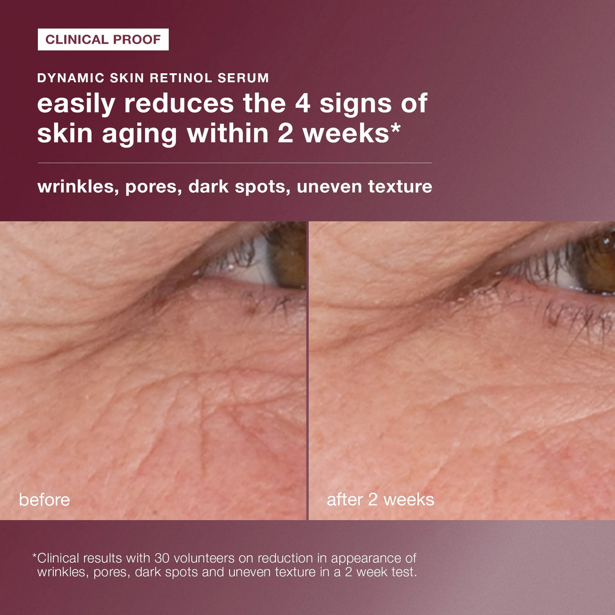 skin aging solutions kit