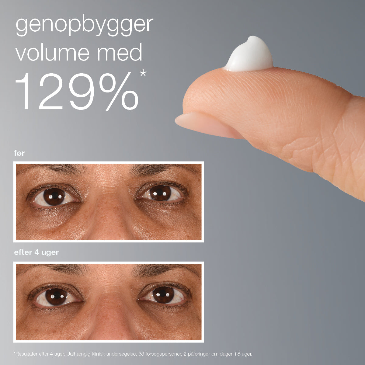 smart eye density