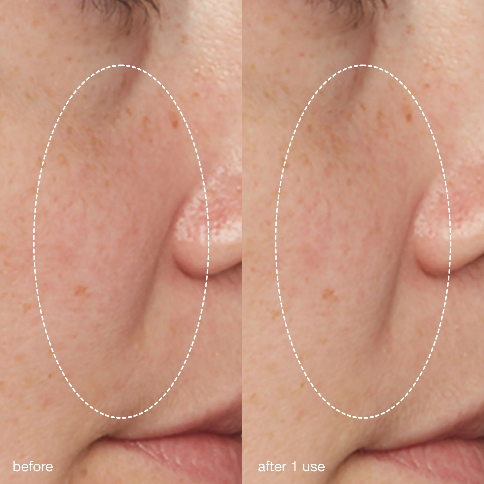 liquid peelfoliant flydende peeling