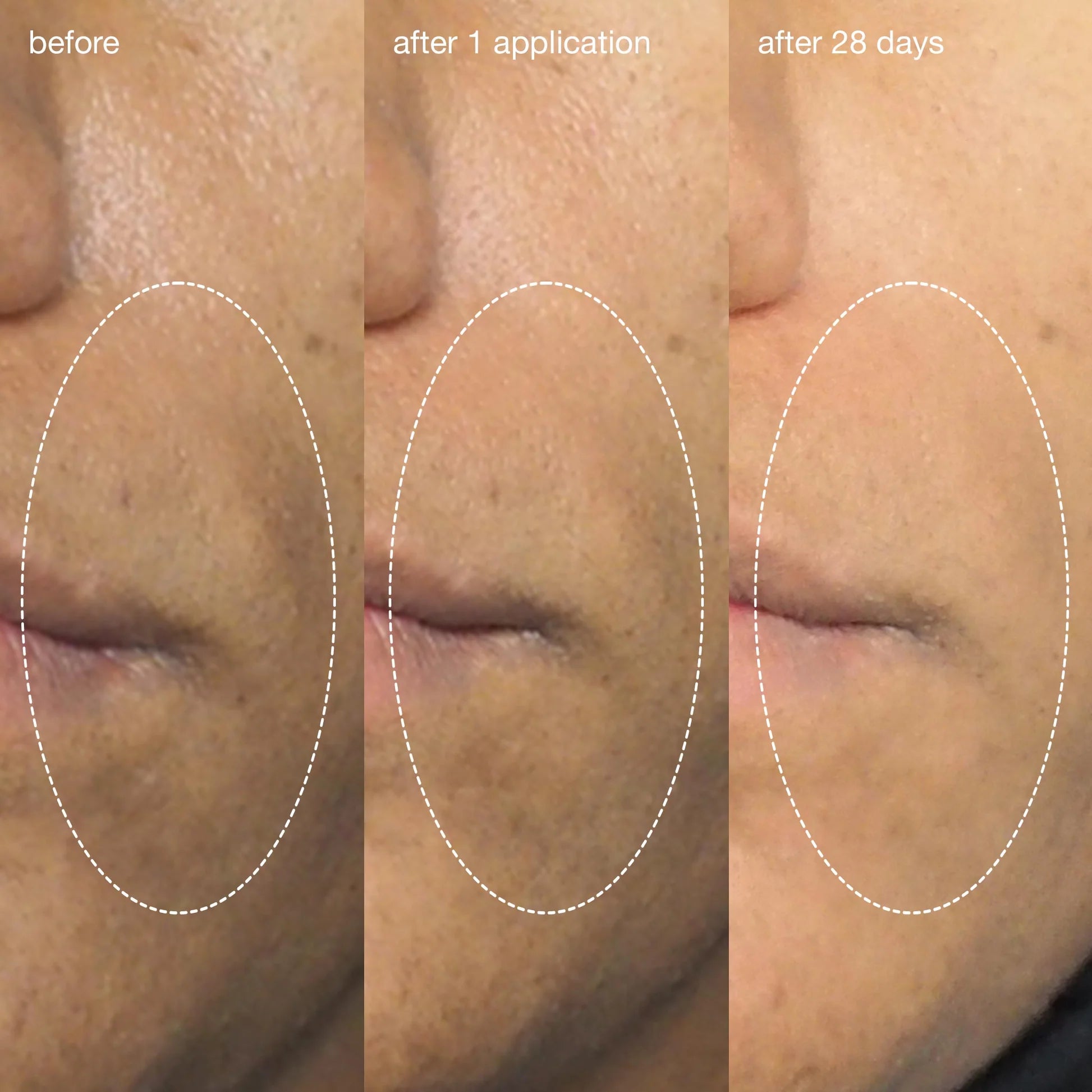 liquid peelfoliant flydende peeling
